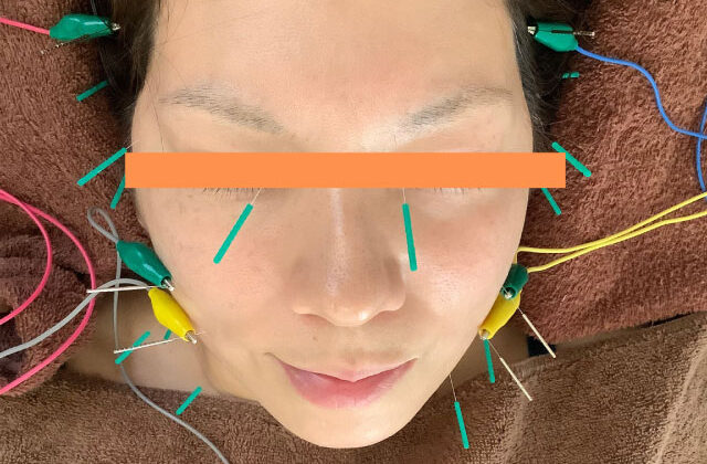 木更津のダイエット専門院 wellnessfit-step