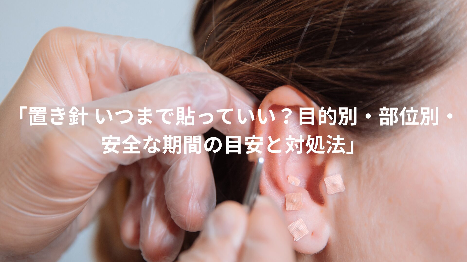 円 皮 鍼 危険